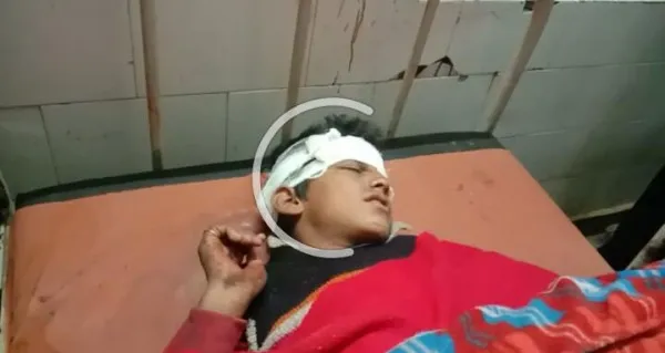 Farrukhabad news:विधुत पोल में उतर आया था करंट,चपेट में आया किशोर