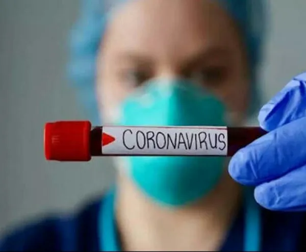 Coronavirus UP Updates:कोरोना का नया रूप.नहीं आता है टेस्ट पॉजिटिव.एक ही परिवार के तीन भाइयों की 24 घण्टे में मौत।