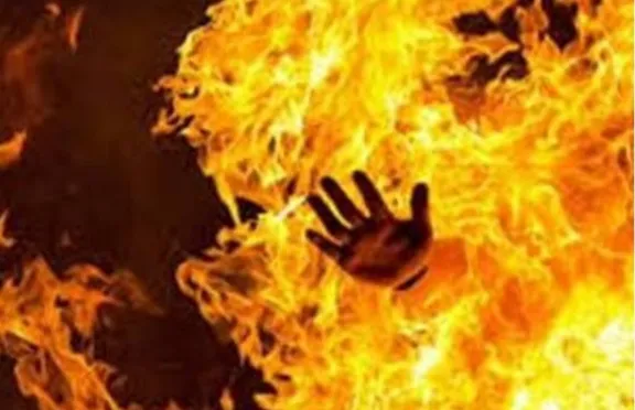 Fatehpur Crime In Hindi: फतेहपुर में पिता की मौत के बाद माँ का सहारा बनी नाबालिग बेटी ने छेड़छाड़ से तंग आकर खुद को लगाई आग