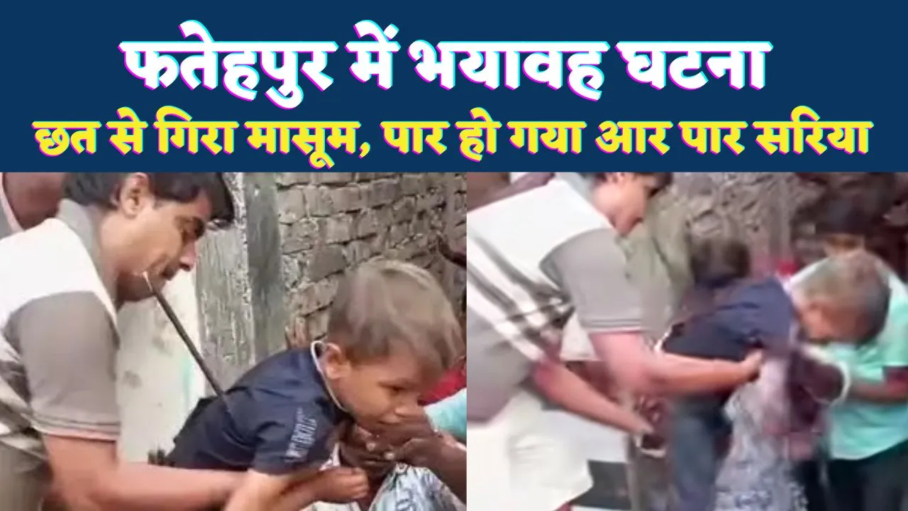 Fatehpur News: फतेहपुर में सनसनीखेज हादसा ! छत से गिरा 5 वर्षीय मासूम, पेट के आर-पार हुआ सरिया