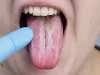 Tongue Colour: जीभ के बदलते हुए रंग से डॉक्टर्स ऐसे लगाते है बड़ी से बड़ी बीमारियों का पता ! आप भी करें चेक