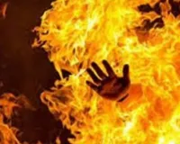 Fatehpur Crime In Hindi: फतेहपुर में पिता की मौत के बाद माँ का सहारा बनी नाबालिग बेटी ने छेड़छाड़ से तंग आकर खुद को लगाई आग