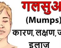 Mumps Disease Outbreak News: बच्चों में पाई जाने वाली ये बीमारी है बेहद खतरनाक ! समय रहते नहीं करवाया इलाज तो बढ़ सकती है मुश्किलें