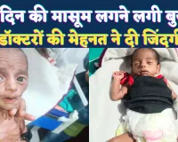 Fatehpur News: 28 दिन की मासूम अचानक दिखने लगी बुजुर्ग, डॉक्टरों की कड़ी मेहनत ने महज 5 दिन में दी नई जिंदगी